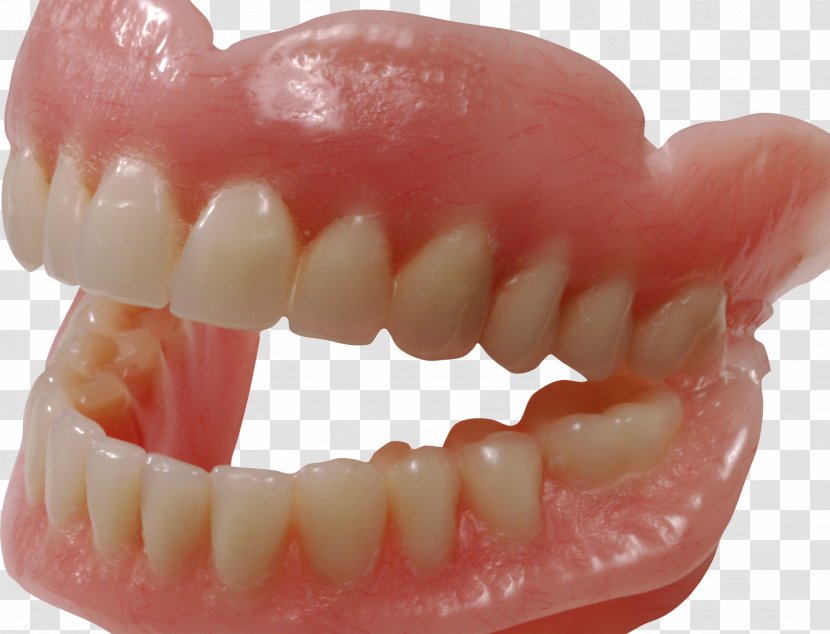 Human Tooth Dentures Clip Art - Pathology Transparent PNG