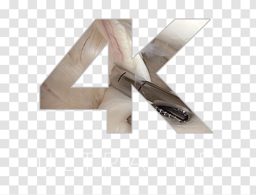 Wood /m/083vt Angle Transparent PNG