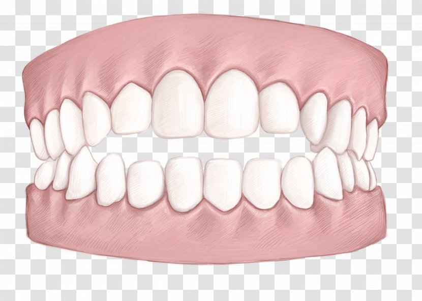 Tooth Dentistry Clear Aligners Dental Braces Mouth - Cartoon - Invisalign Pennant Transparent PNG