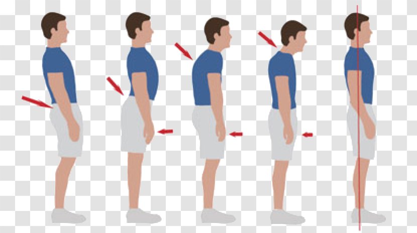 Posture Shoulder Human Back Fascia Pain In Spine - Cartoon - Tree Transparent PNG