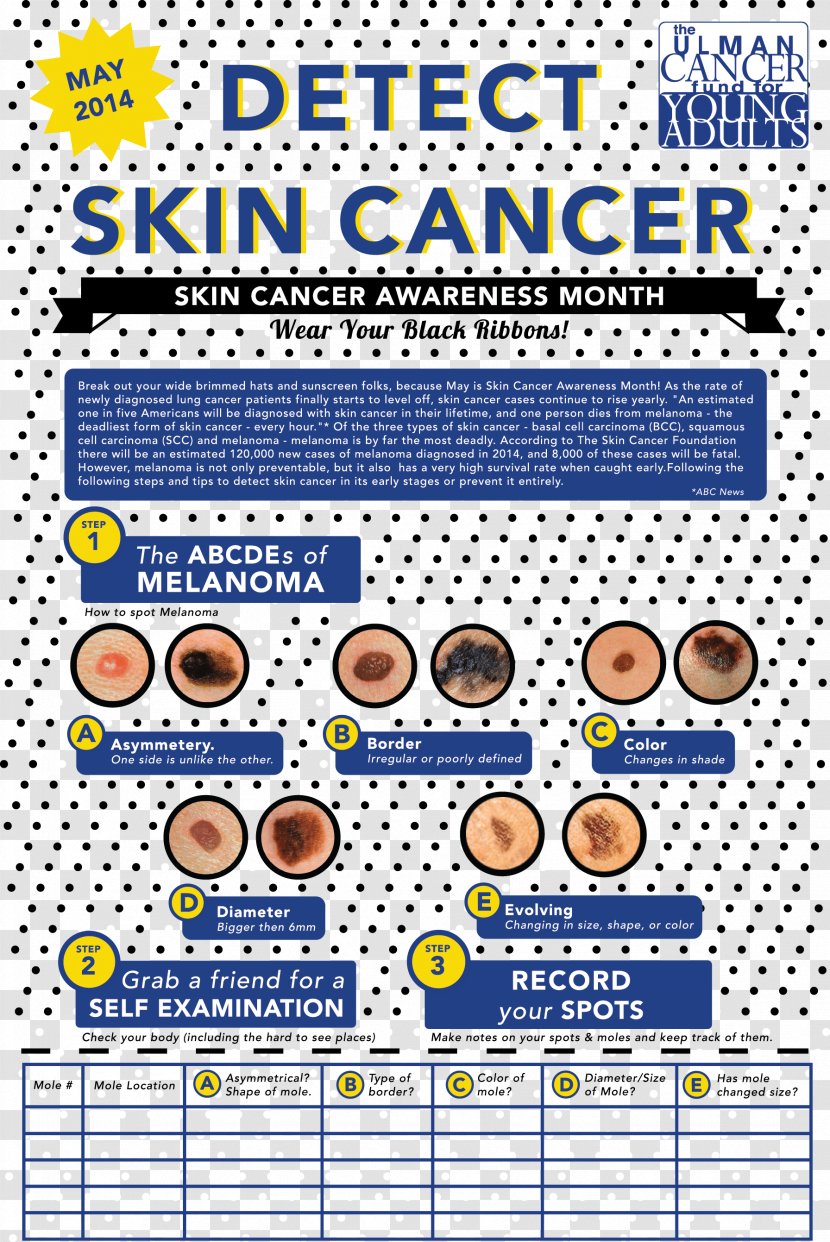 Skin Cancer Foundation Carcinoma Melanoma - Squamous Cell Transparent PNG