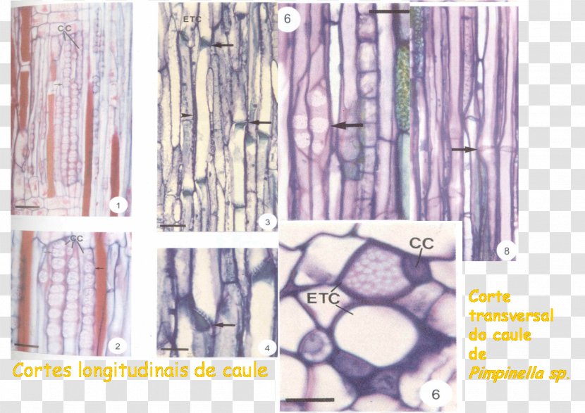 Cell Phloem Sieve Tube Element Xylem Tissue - Tree - Asteraceae Transparent PNG