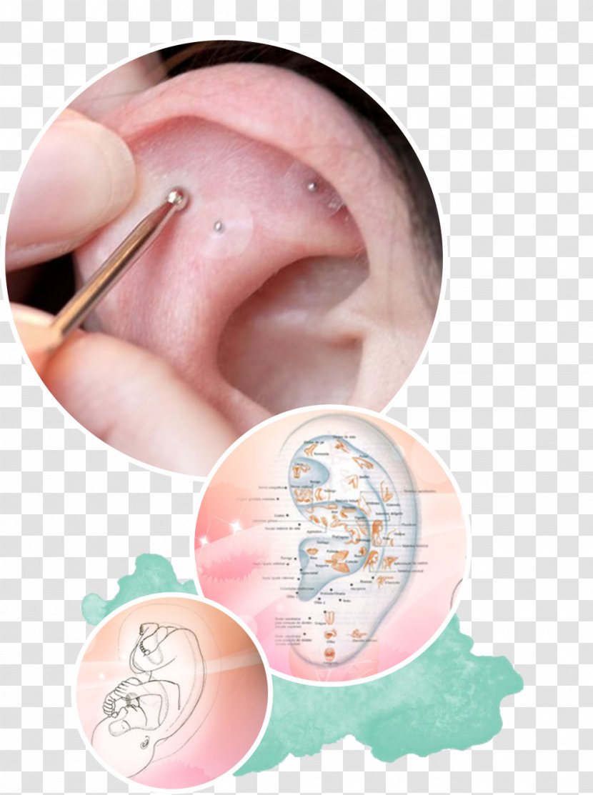 Auriculotherapy Acupuncture Auricle Ear - Chin Transparent PNG