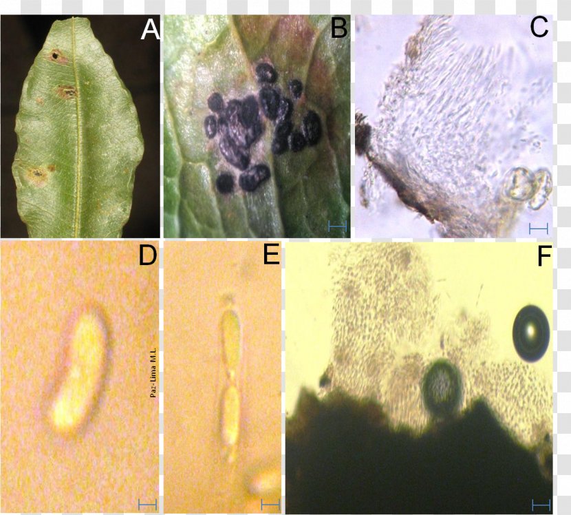 Colletotrichum Sordariomycetes Plant Pathology Fungus Transparent PNG