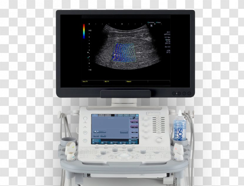 Ultrasonography Medical Equipment Diagnosis Hospital Technology - Radiation Efficiency Transparent PNG