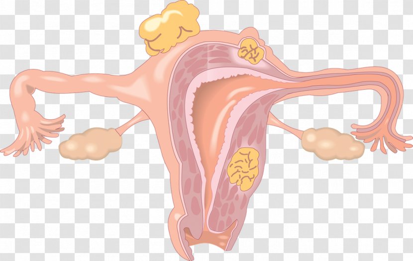 Ovary Uterine Fibroid Uterus Hormone Replacement Therapy Gynaecology - Frame - Organs Transparent PNG