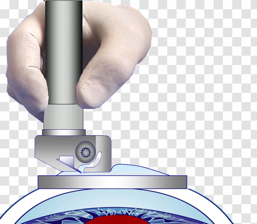 LASIK Expert Technology Experience - Joint Transparent PNG