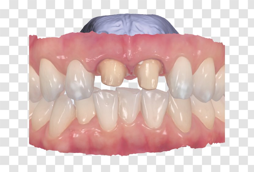 Tooth Dentistry Fingerprint Crown Transparent PNG