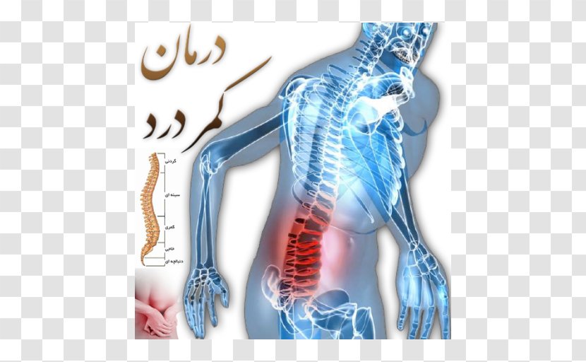 Pain In Spine Lumbar Disc Herniation Low Back Vertebral Column - Flower - Backpain Transparent PNG