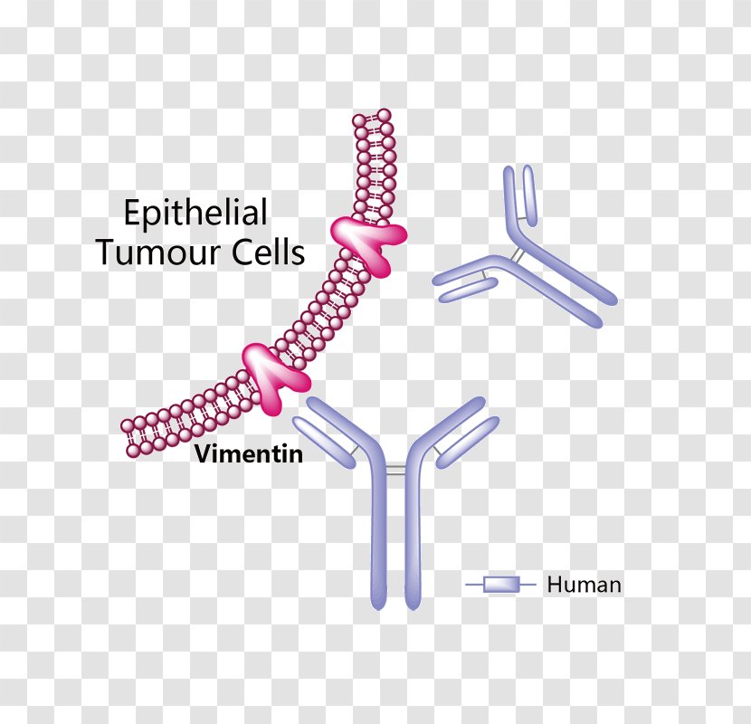 Trastuzumab Emtansine Erenumab Pharmaceutical Drug Vemurafenib - Glioma Transparent PNG