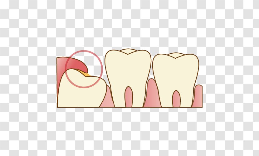 Wisdom Tooth Dentist 歯科 Dental Extraction - Cartoon - Shiraz Transparent PNG