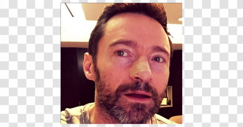 Hugh Jackman The Wolverine Sunscreen Skin Cancer Actor - Xmen Transparent PNG