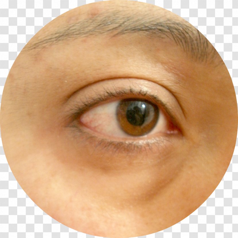 Eyelash Extensions Chin Wrinkle Cheek Eyebrow - Cartoon - Eye Patch Transparent PNG