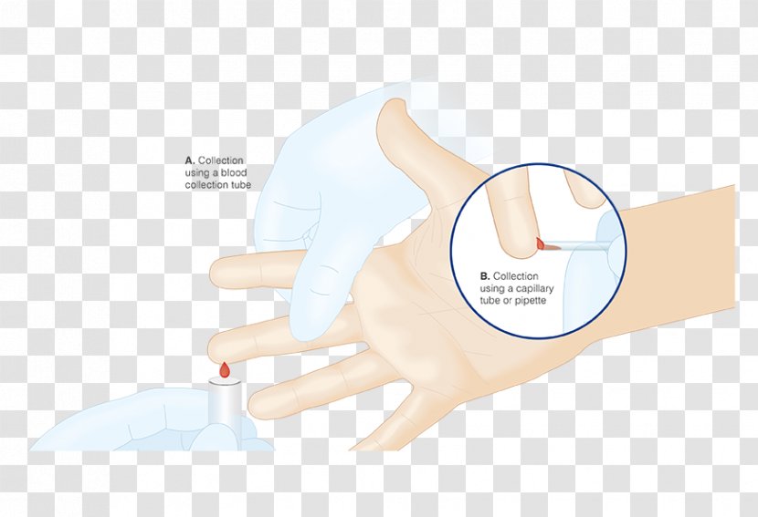 Thumb Medical Glove Hand Model - Blood Sample Transparent PNG