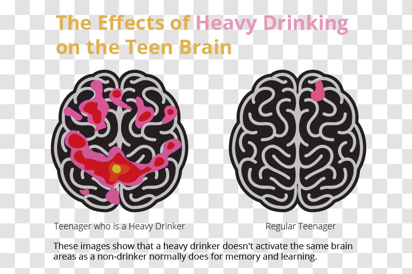 Brain Alcoholism Alcoholic Drink Alcohol And Health Binge Drinking - Frame Transparent PNG