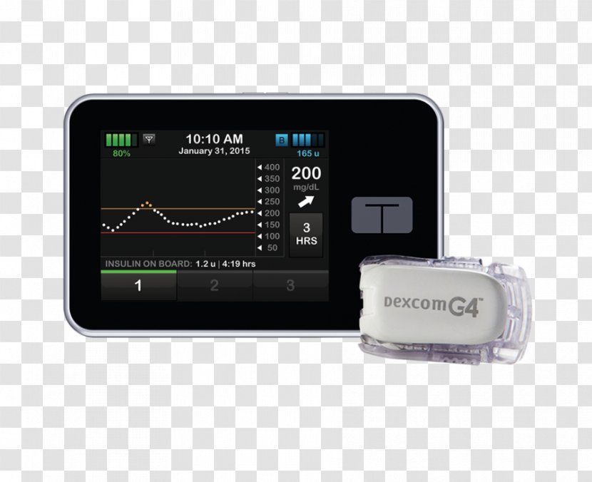 Dexcom Continuous Glucose Monitor Insulin Pump Blood Monitoring Diabetes Mellitus - Diabetic Products Transparent PNG