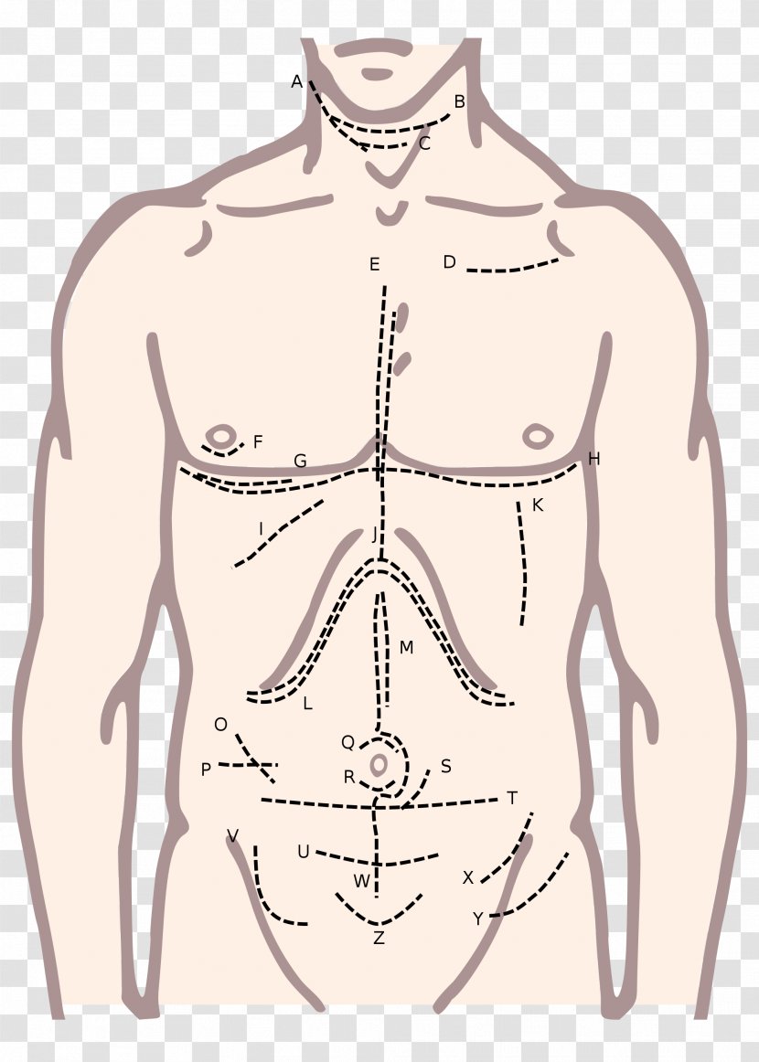 Surgical Incision Surgery Xiphoid Process McBurney's Point Median Sternotomy - Watercolor - Silhouette Transparent PNG