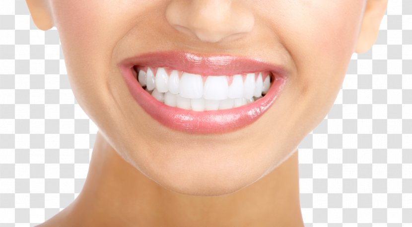 Tooth Whitening Human Cosmetic Dentistry - Lip - White Teeth Clipart Transparent PNG