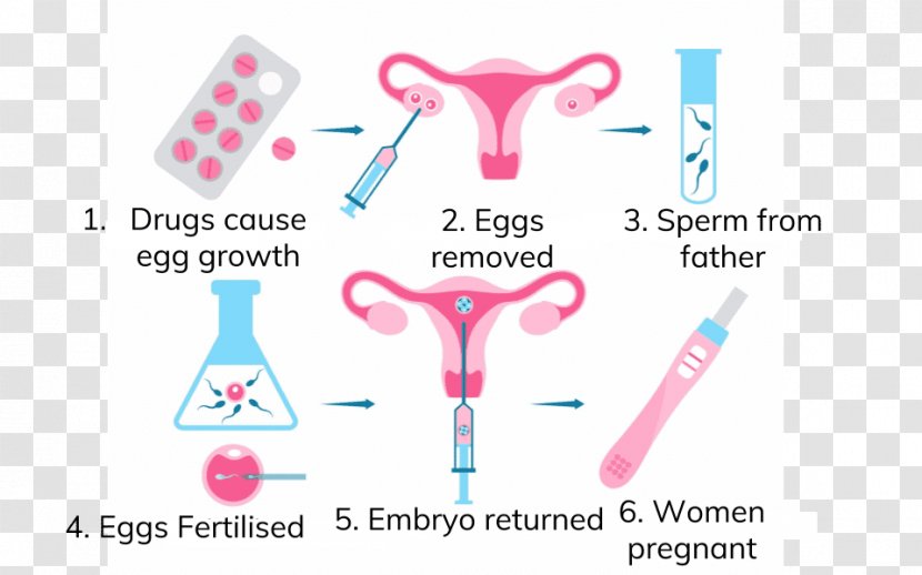 In Vitro Fertilisation Assisted Reproductive Technology Human Fertilization - Fashion Accessory - Pregnancy Transparent PNG