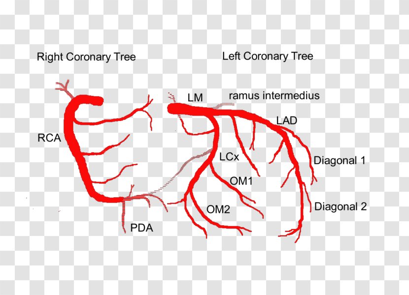 Coronary Arteries Anatomy Circulation Anterior Interventricular Branch Of Left Artery Heart - Cartoon Transparent PNG