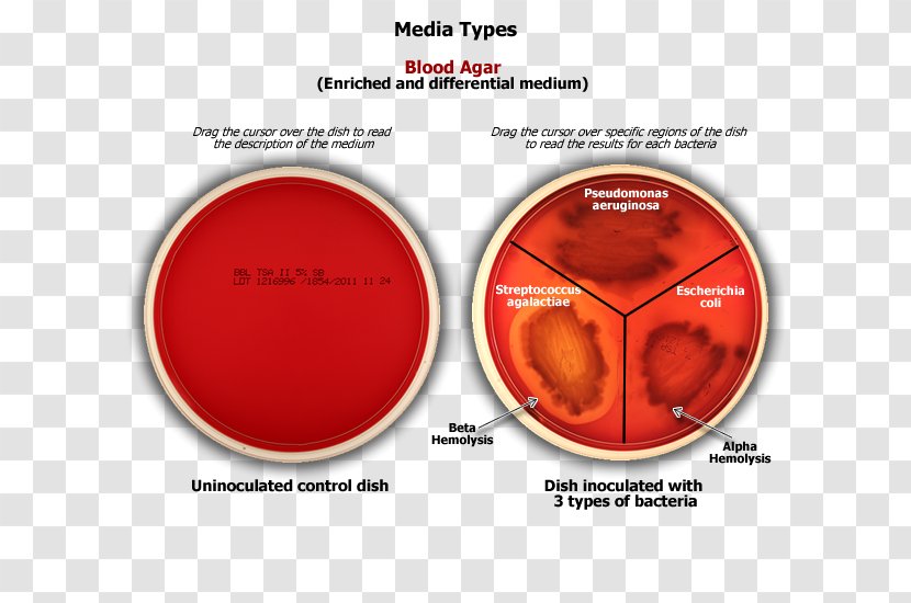 Agar Plate Growth Medium Sang MacConkey - Blood Transparent PNG