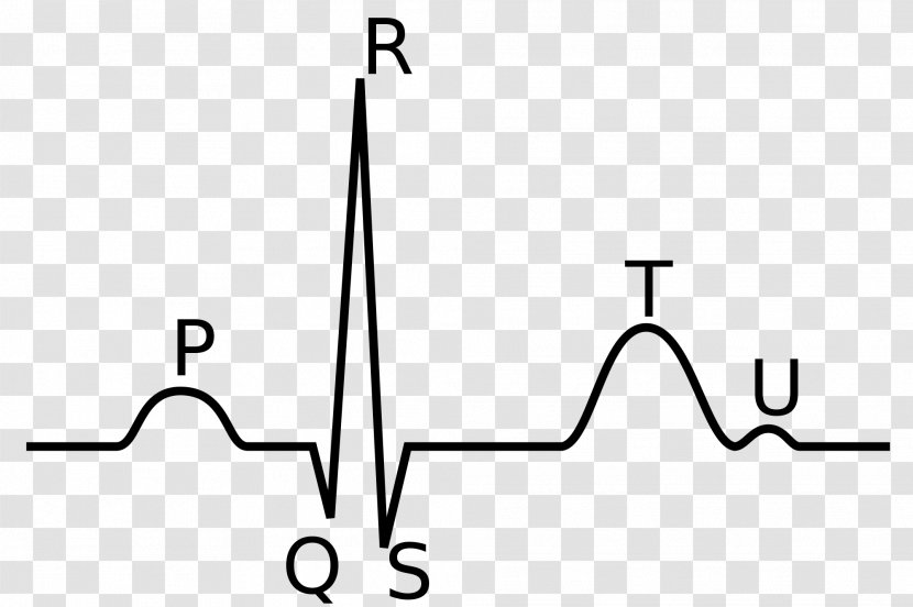 QRS Complex Electrocardiography P Wave Heart Depolarization - Atrium - Ecg Transparent PNG