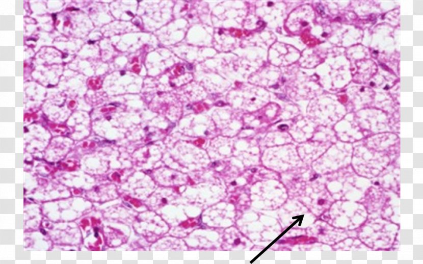 Brown Adipose Tissue Histology Connective - Lilac Transparent PNG