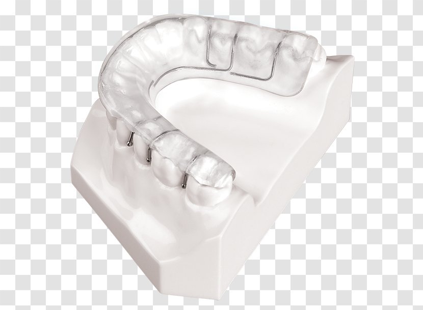 Jaw Mandible Occlusal Splint Maxilla - Dorsal Fin Transparent PNG