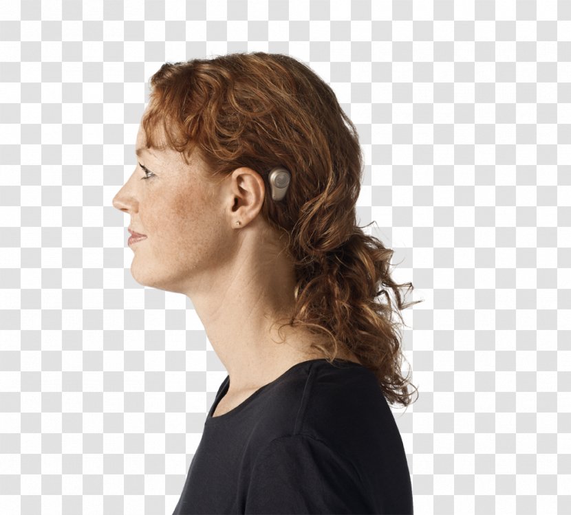 Bone-anchored Hearing Aid Ear Pain Cochlear Implant - Middle - Ears Transparent PNG