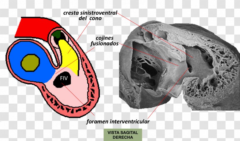 Interventricular Septum Primary Foramen Embriologia Humana Foramina Embryology - Silhouette - Tree Transparent PNG