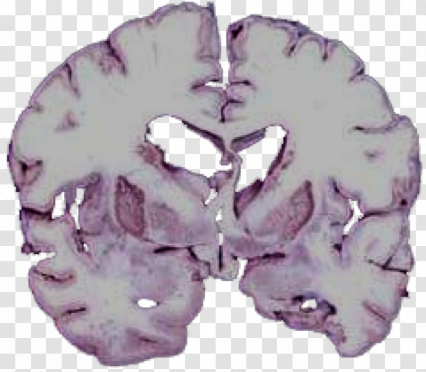 Brain Medicine Organism - Frame Transparent PNG