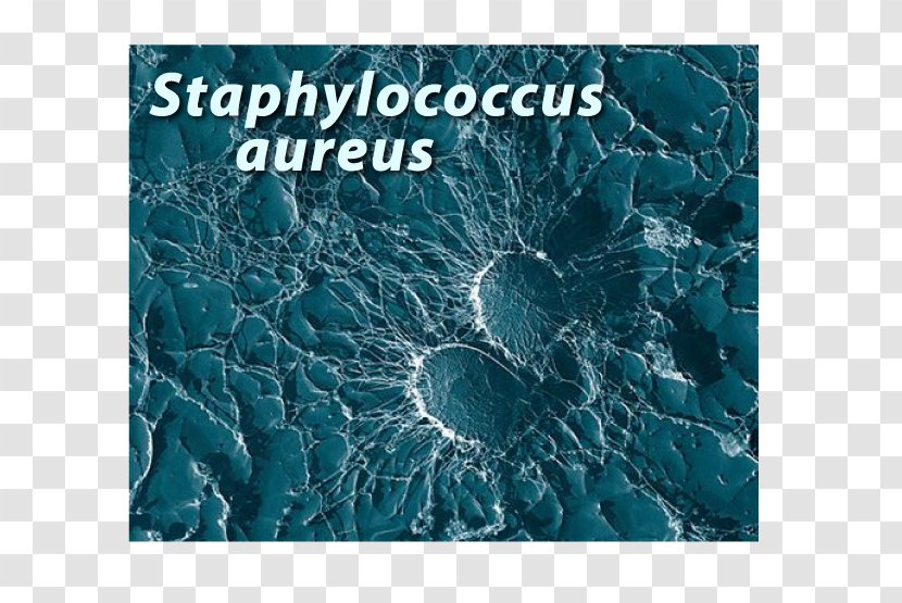 Staphylococcus Aureus Bacteria Infection Disease Strain - Texture - Pointing Transparent PNG
