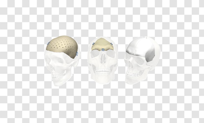Skull Stryker Corporation Implant Jaw Bone - Medical Imaging - Implants Transparent PNG