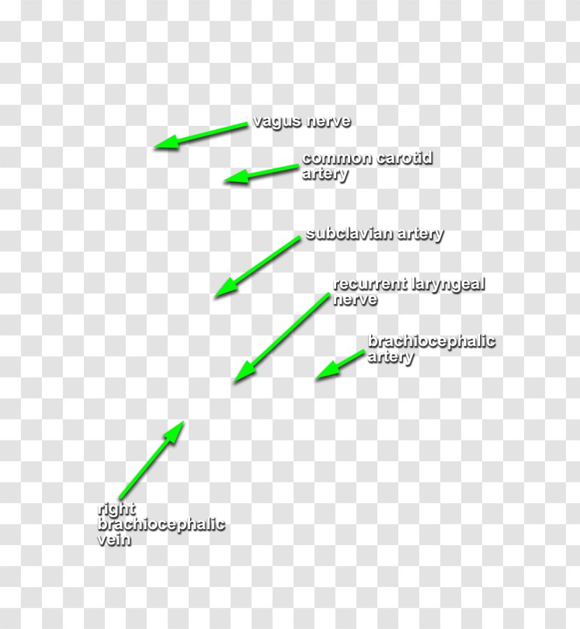 Line Diagram - Green Transparent PNG