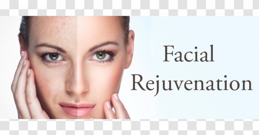 Facial Rejuvenation Surgery Photorejuvenation - Plastic - Face Transparent PNG