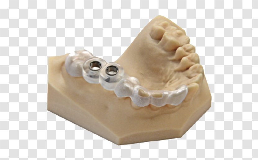 3D Printing Rapid Prototyping Computer Graphics Dentistry - 3d Systems - Wax Transparent PNG