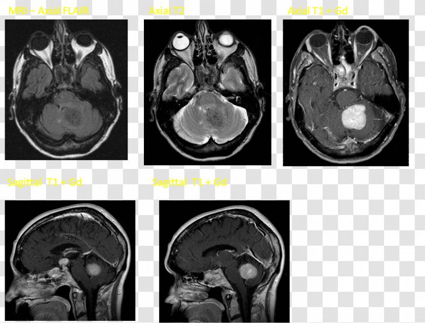 Computed Tomography Brain Font - Heart Transparent PNG