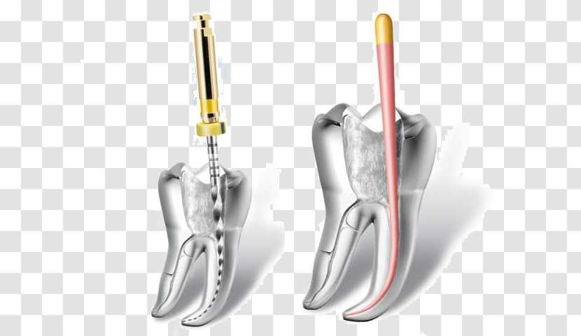 Endodontic Therapy Endodontics Root Canal Dentistry - Dentist - Health Transparent PNG