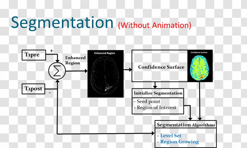 Image Segmentation Brain Tumor Magnetic Resonance Imaging Neoplasm - Technology Transparent PNG