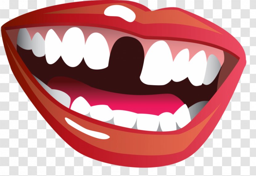 Human Tooth Smile Edentulism Dentistry - Cartoon Transparent PNG