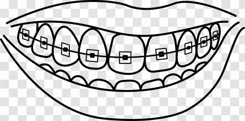 Dental Braces Dentistry Human Tooth Drawing - Silhouette - Cavity Transparent PNG
