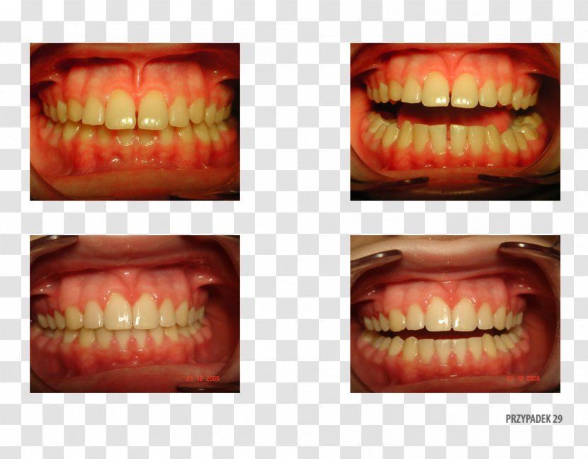 Orange Polska Tooth Patient Therapy - Smile Transparent PNG