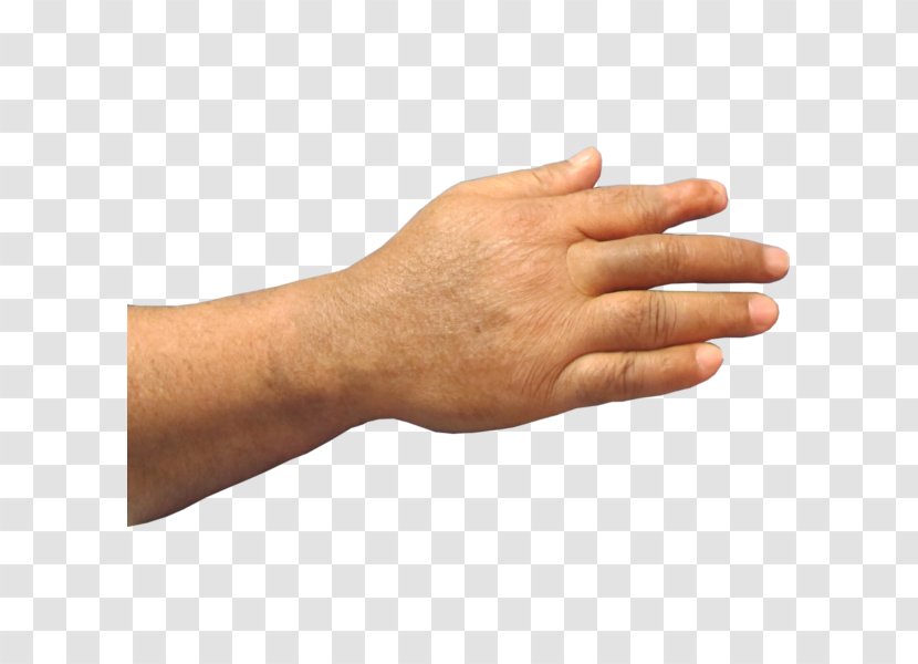 Thumb Prosthesis Hand Amputation Finger - Little Transparent PNG