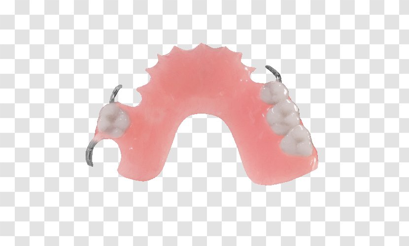 Dentures Removable Partial Denture Dentistry Dental Laboratory Jaw - Clinic Transparent PNG