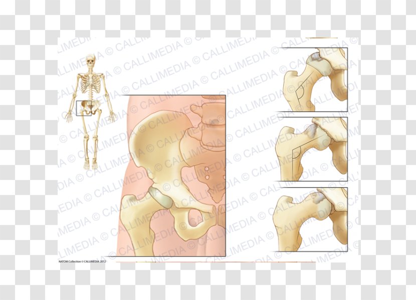 Hip Arthritis Femur Greater Trochanter Lesser - Cartoon - Ráº¯n 3d Transparent PNG