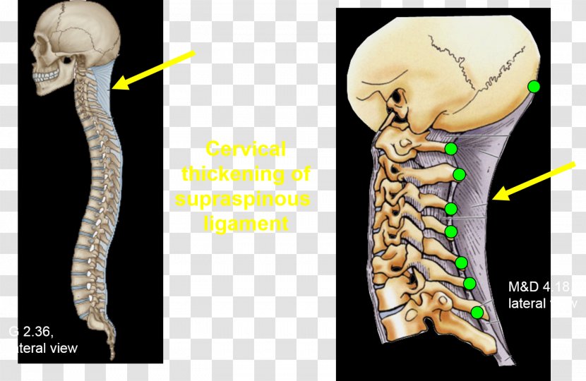 Shoulder Skeleton Organism - Neck Transparent PNG