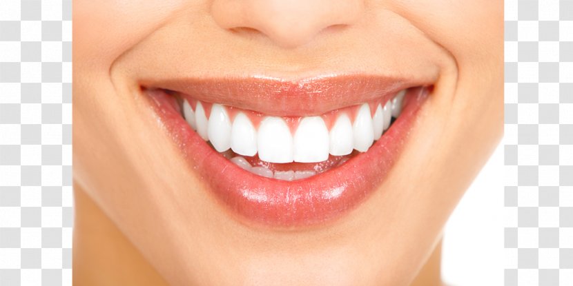 Cosmetic Dentistry Smile Human Tooth - Face Transparent PNG