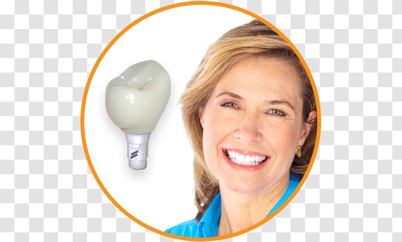 Tooth Dental Implant Dentistry - Dentist - Implants Transparent PNG
