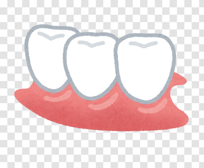 Dentures Dentist Tooth Removable Partial Denture Therapy Transparent PNG