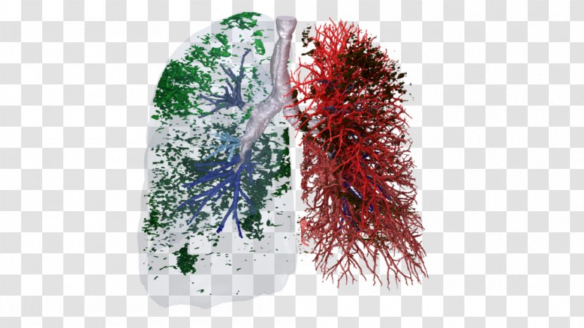 European Respiratory Society Idiopathic Pulmonary Fibrosis Tract Chronic Obstructive Disease Lung - Unicat Catalyst Technologies Transparent PNG